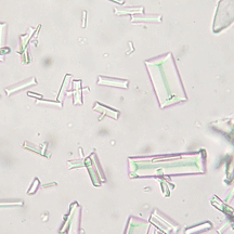 STRUVITE